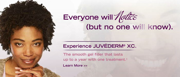 Juvederm XC