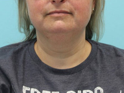 Necklift